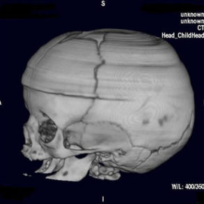 Skull 3D 380